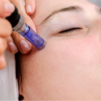 NANO CHANNELING (ADD ON) at Ritual Beauty in Syracuse, NY