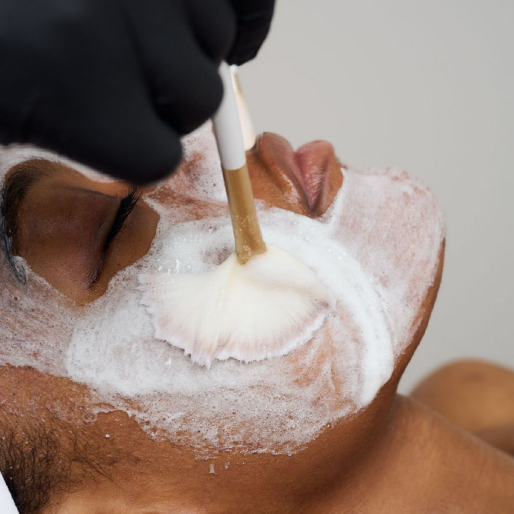 Acne Clarity Series at Dew+Glow Aesthetics in Snellville, GA