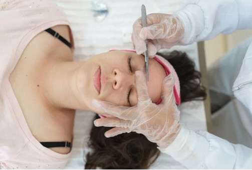 Dermaplaning