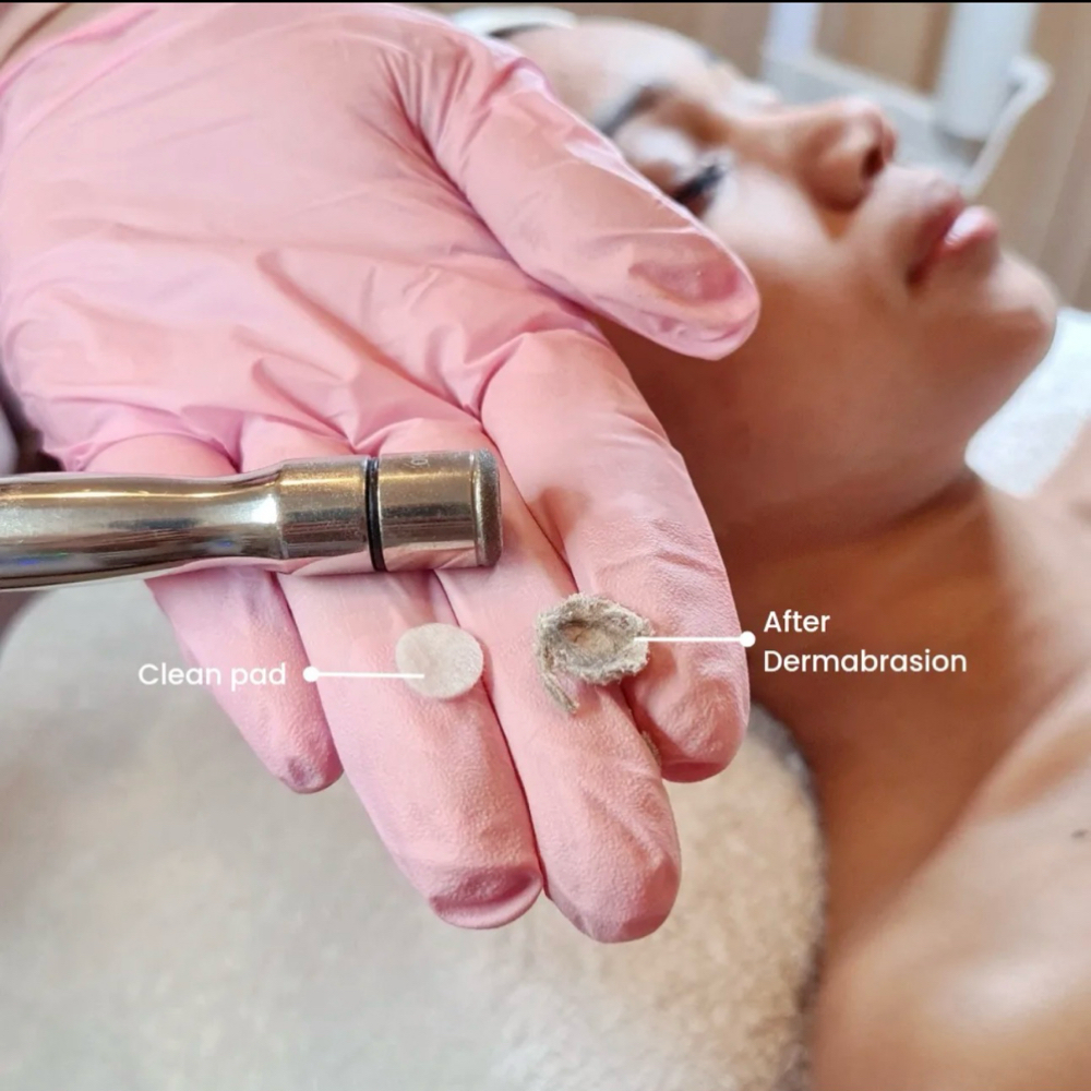 Microdermabrasion Facial at Amethyst Spa in Omaha, NE