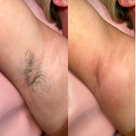 Underarm wax