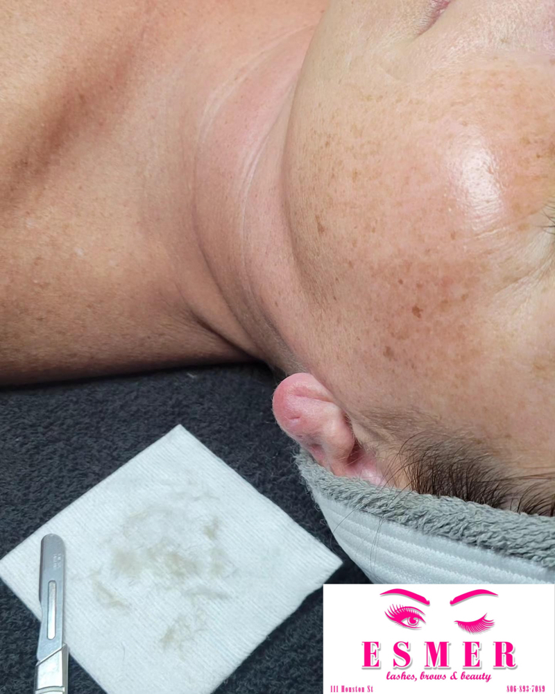 Dermaplaning Only
