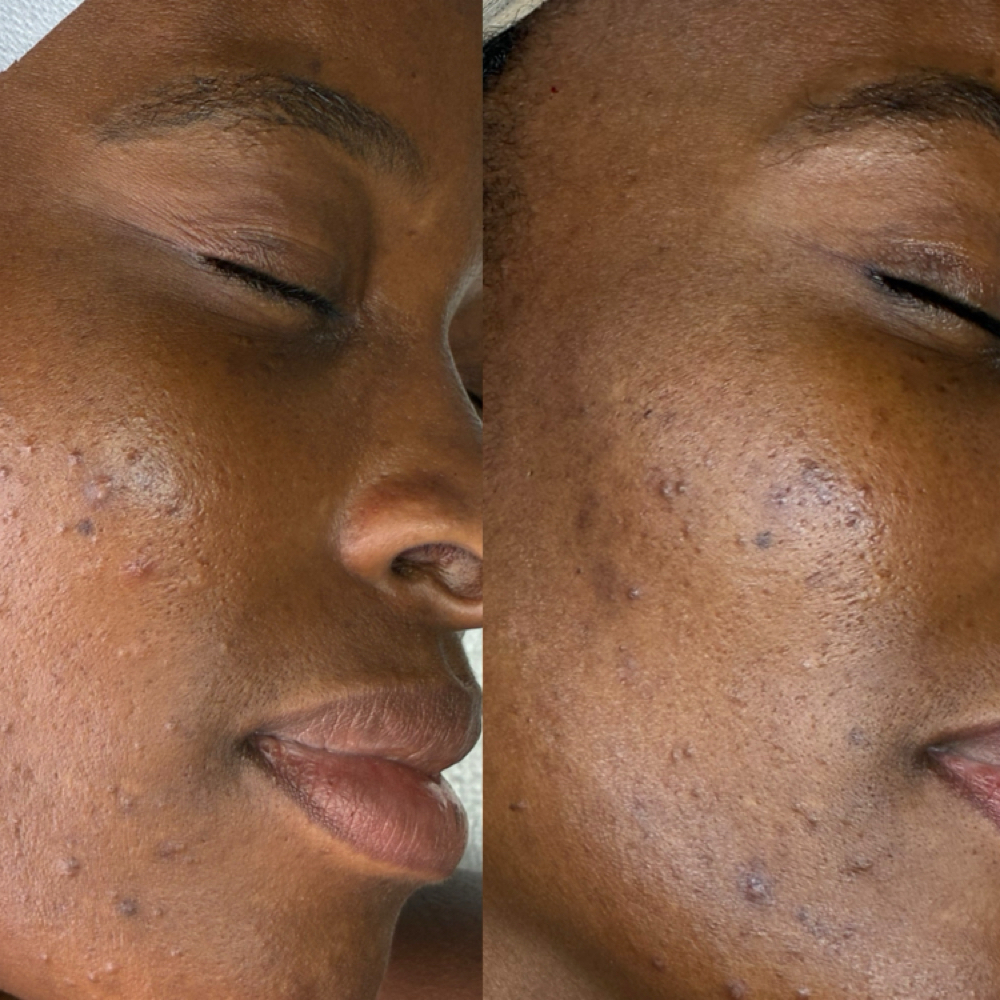 Level 2 Signature Facial at Oasiah Aesthetics in New York, NY