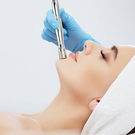 Diamond Dermabrasion