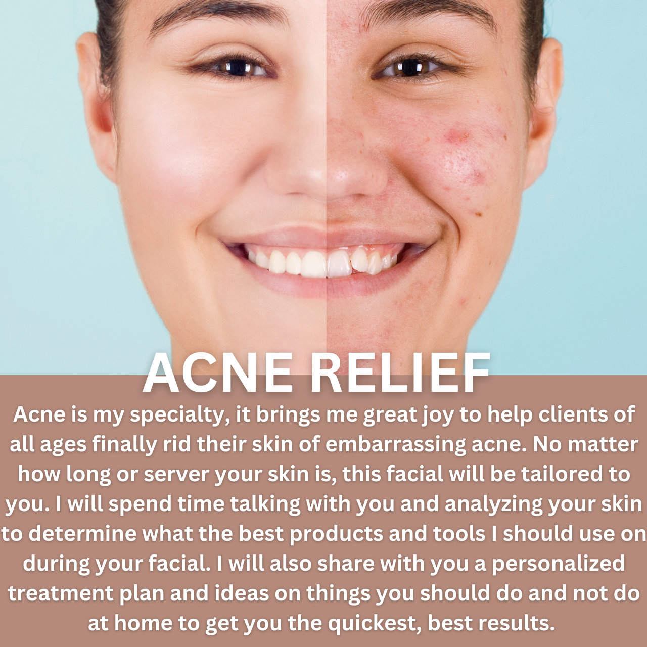 ACNE RELIEF