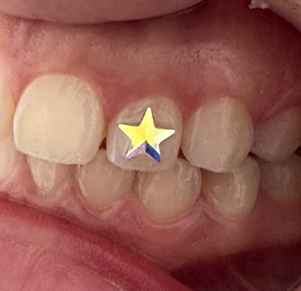 Specialty Tooth Gem