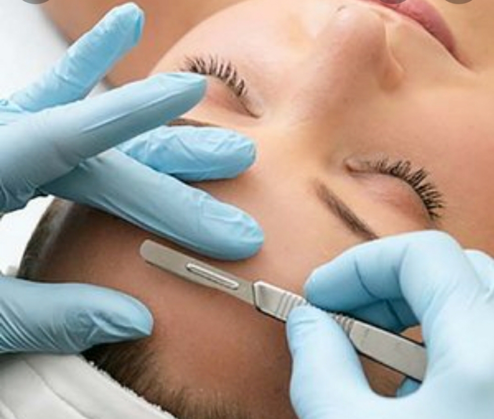 Dermaplaning Treatment