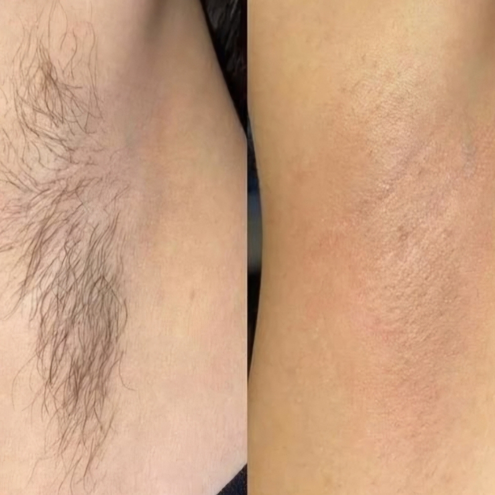 Under Arms Wax at Entouch Day Spa  |   La Pine's Premier Facial Spa & Waxing Studio in La Pine, OR