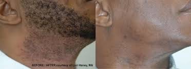 Mens Beard