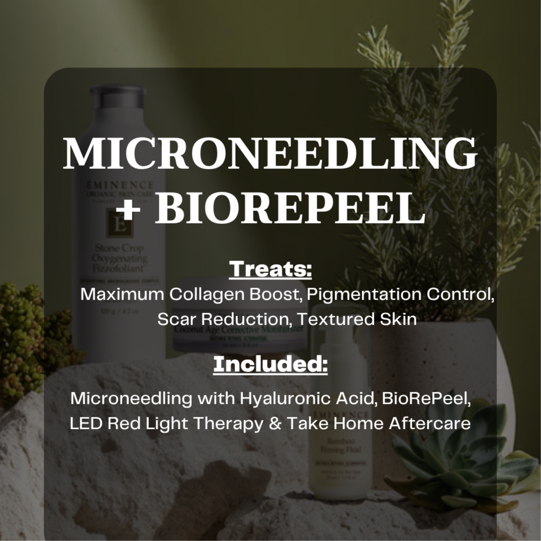 Microneedling + BioRePeel at Skin Deep Beauty in Scottsdale, AZ