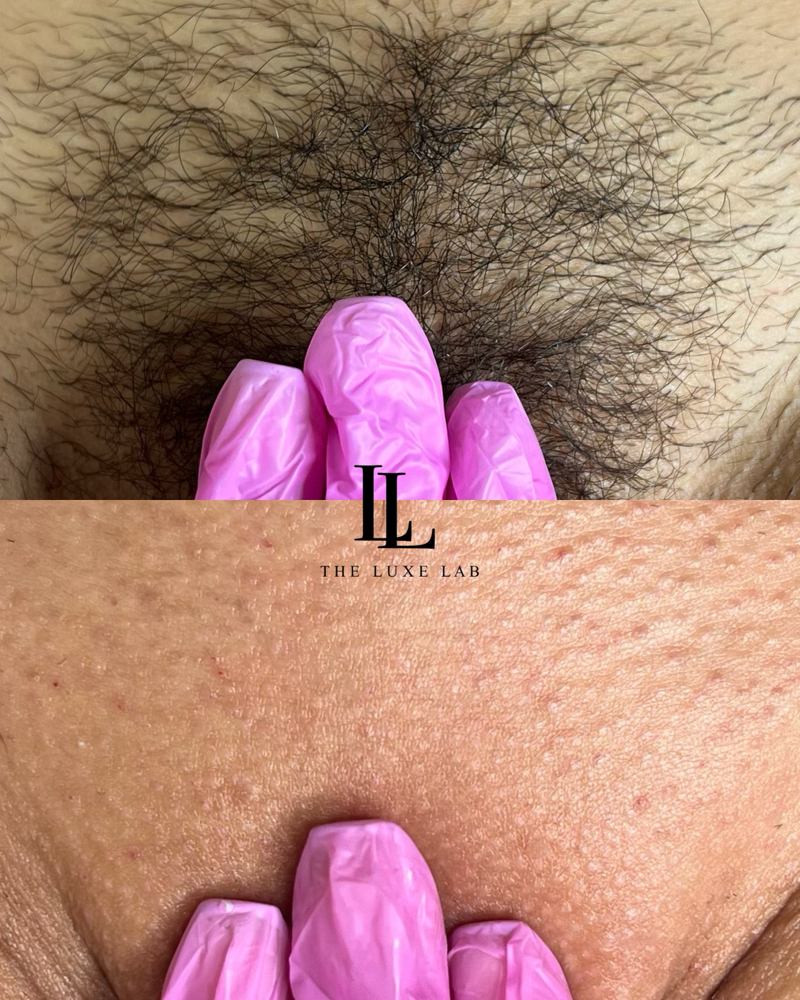 ✨New Client Brazilian✨ at The Luxe Lab in New Brunswick, NJ