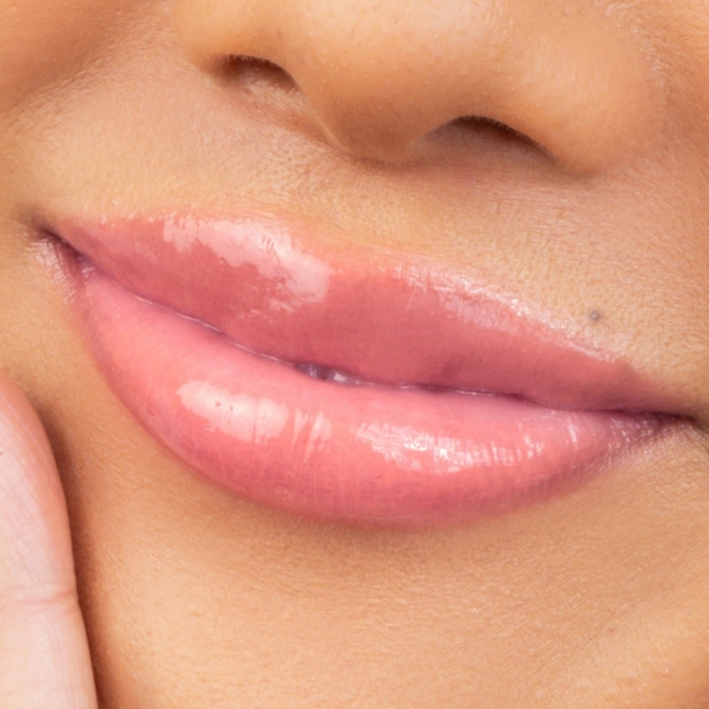 Lip Treatment Add-on at Majestic Aesthetics by jaki in Worthington, OH