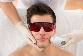 Full Face-Laser Hair Removal