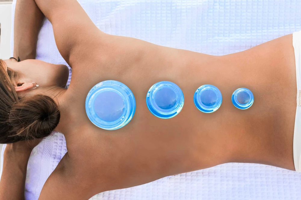 60 Minute Cupping Treatment