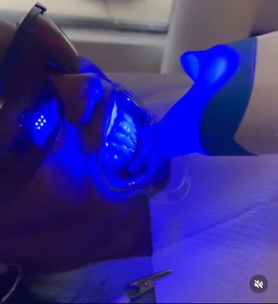Smile Teeth Whitening