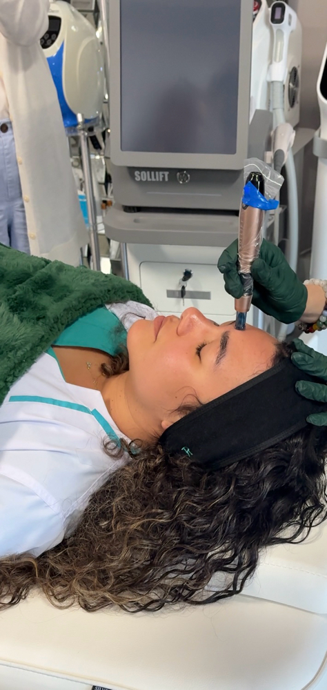 Microneedling