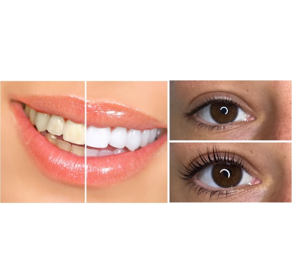 60 Teeth Whitening/ Lash Lift +Tint