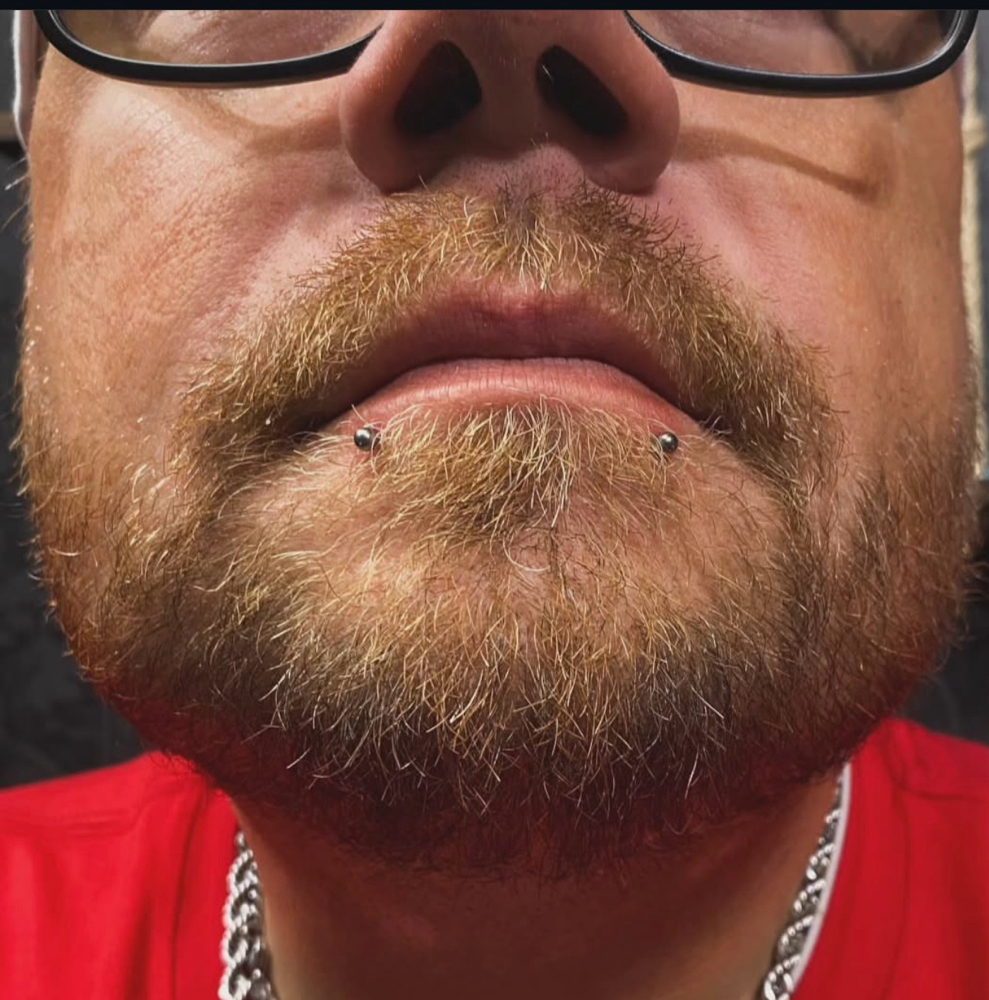 Snake Bites