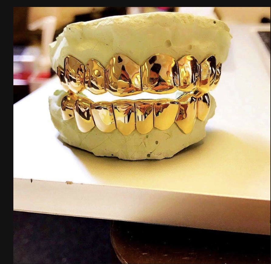 Gold Grillz