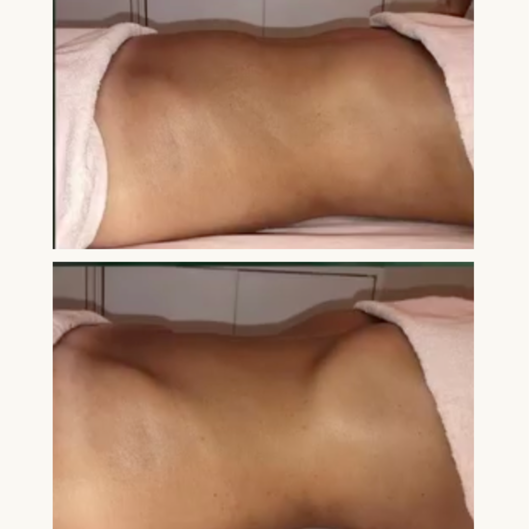 CurvSculpt Method at CurvSculpt in Denver, CO