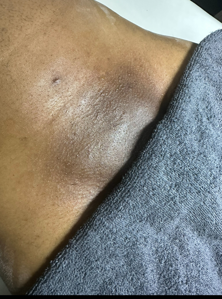 Manzilian (Intimate Wax For Men)