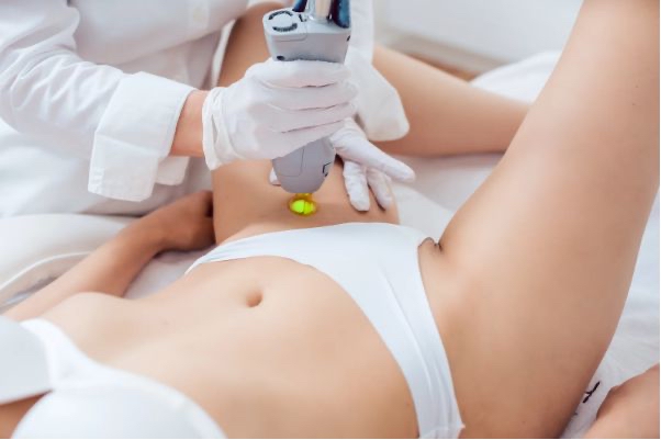 Laser Hair Removal: Brazilian