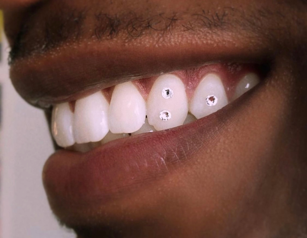 3 Swarovski Tooth Gems