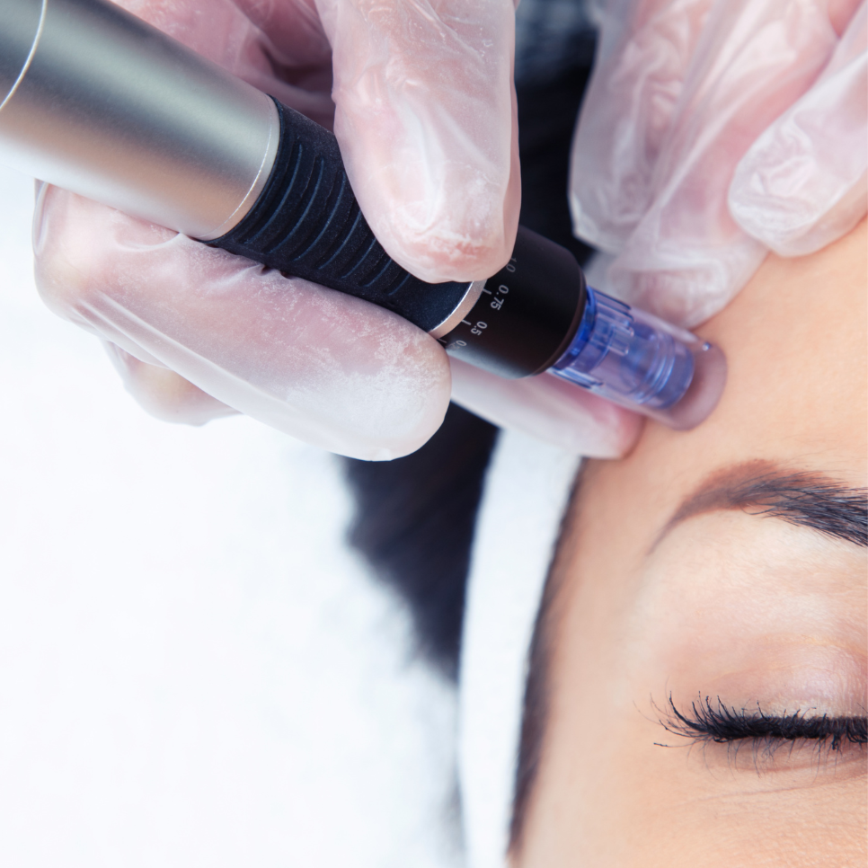 The Eden Renewal Facial at Eden Rose Health and Wellness in Bridgeport, CT