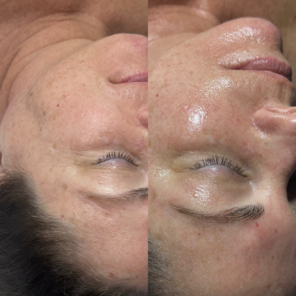 Brighten & Tighten Vitamin C Facial at The Beauty Bank in Oklahoma City, OK