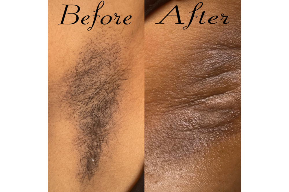 Underarms/BrazilianWax/Vacial