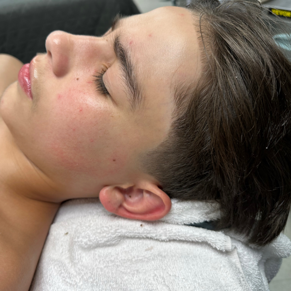 Teen Facial✨ at ACESTHETICS LLC in Milford, CT