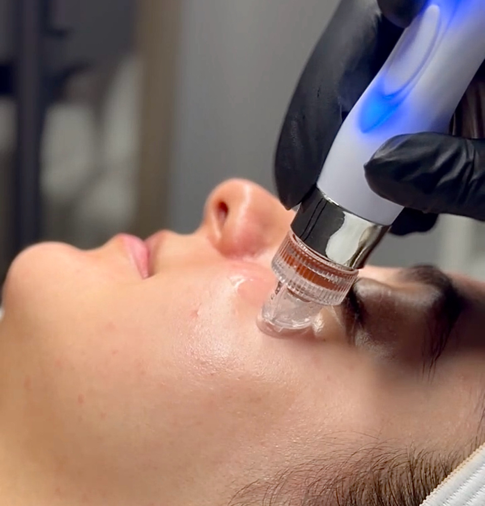 Hydrofacial, Dermaplane and LED