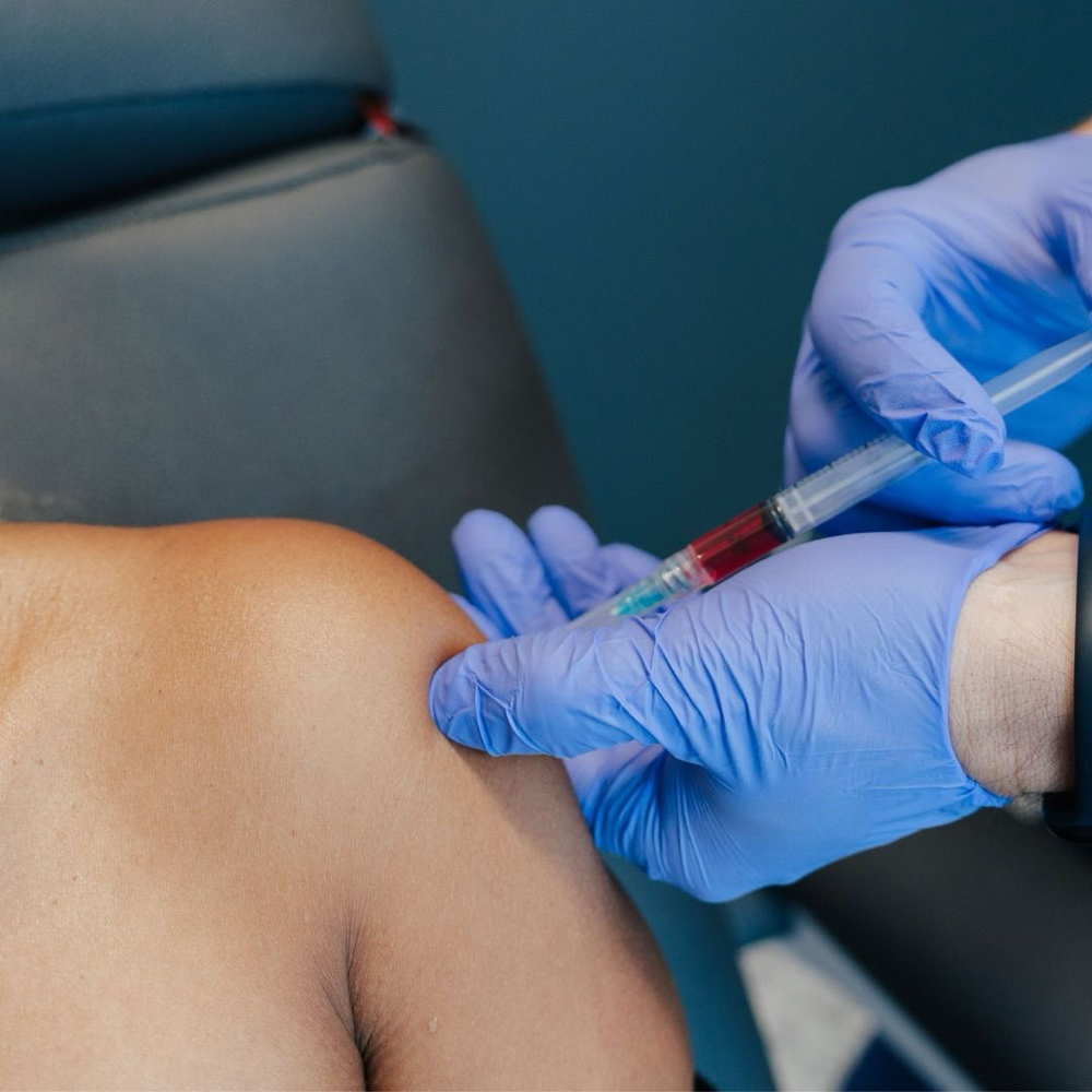 B12 Shot