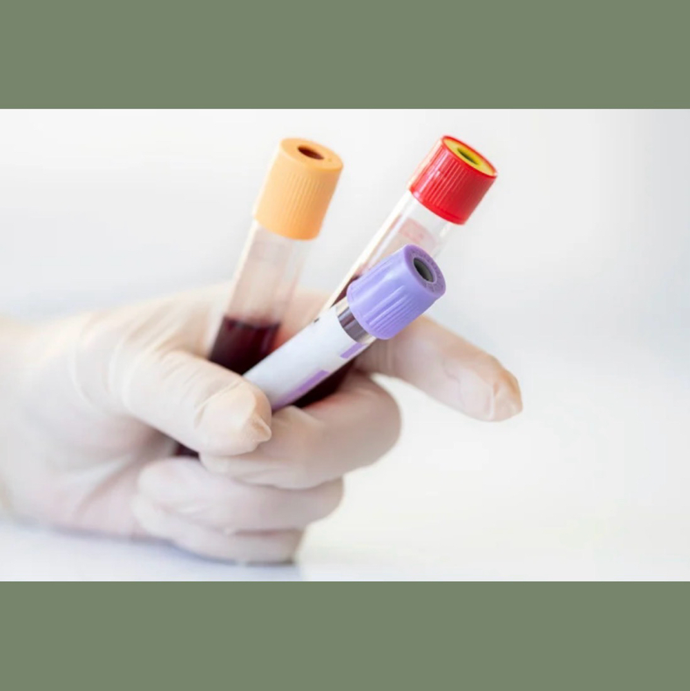 Member Lab Draw (Provider-Directed) at Altera Health in Shenandoah, TX