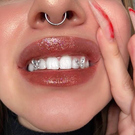 Double Butterfly Set at Luxe Glow Smiles in orlando, FL