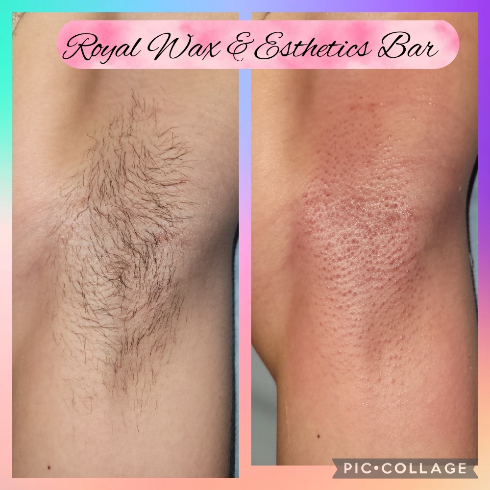 Underarm Wax
