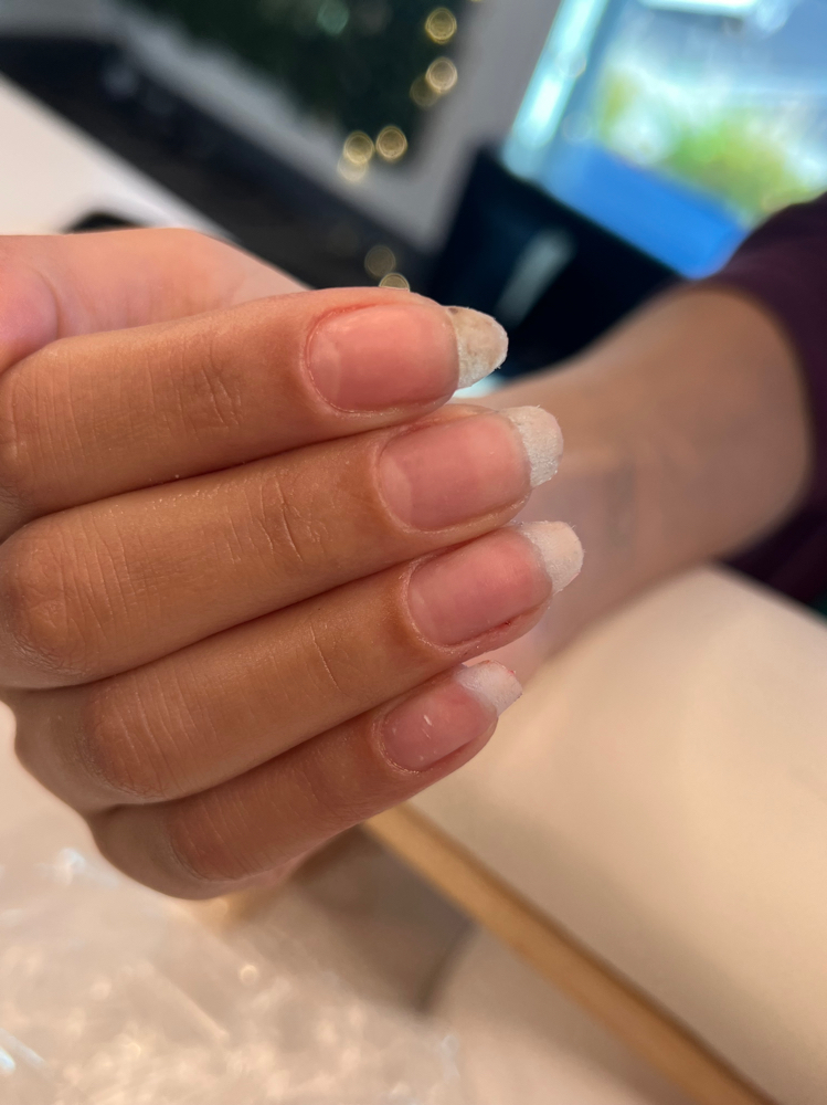 Nail Fix(s)