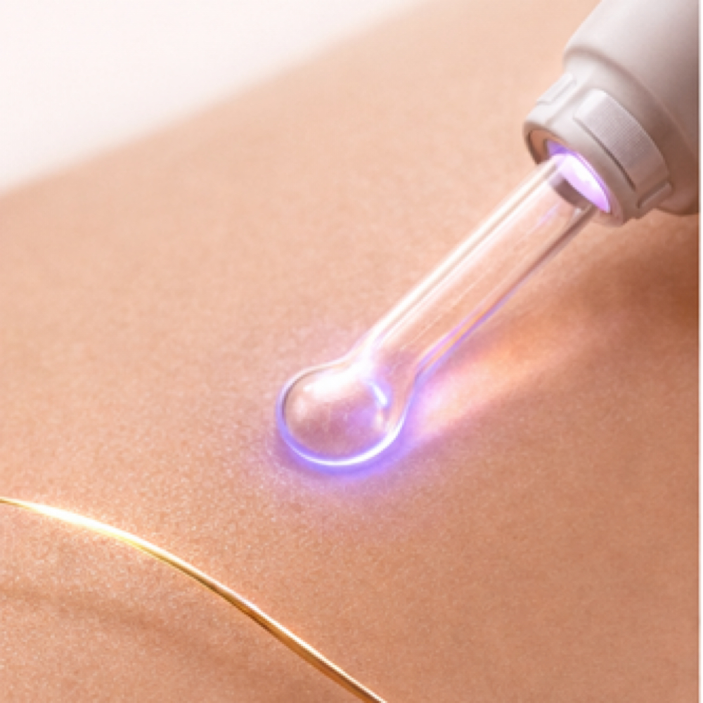 Ingrown Therapy at ALL WAXX’D UP, INC. in Murrieta, CA