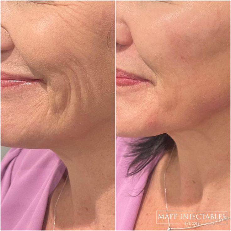 Anti-Age Intensive Treatment