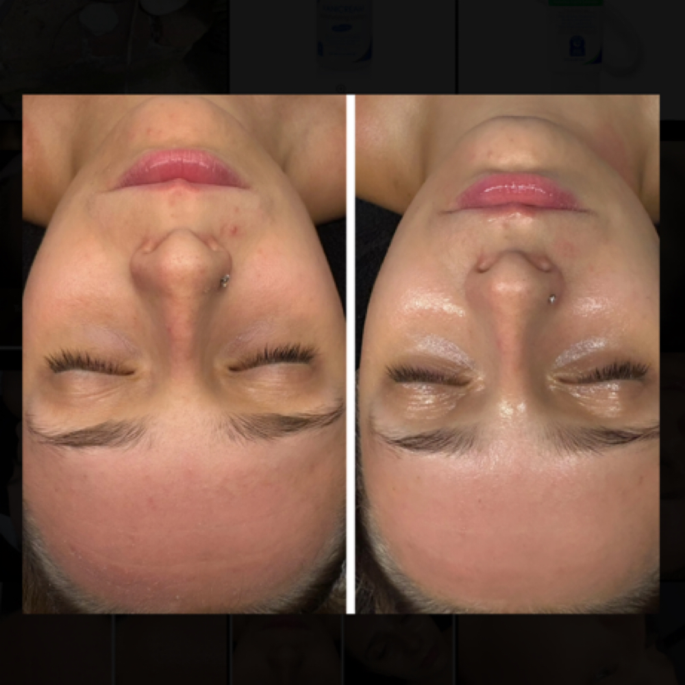 Bridal Skin Journey at Serenity By Sarina in Riverside, RI