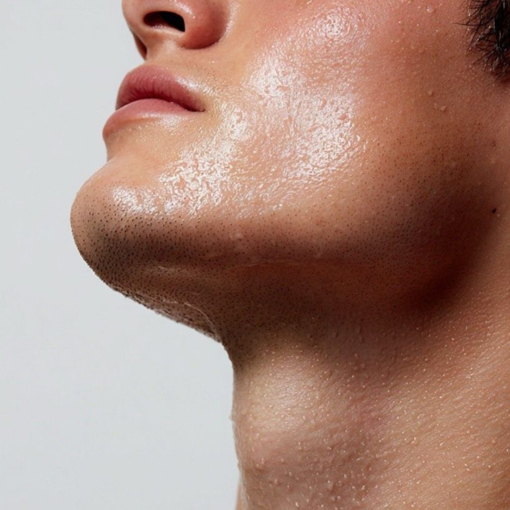 Custom Corrective Peel at VERS. Skin & Beauty in Syracuse, UT