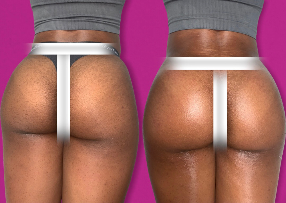 Butt Wax