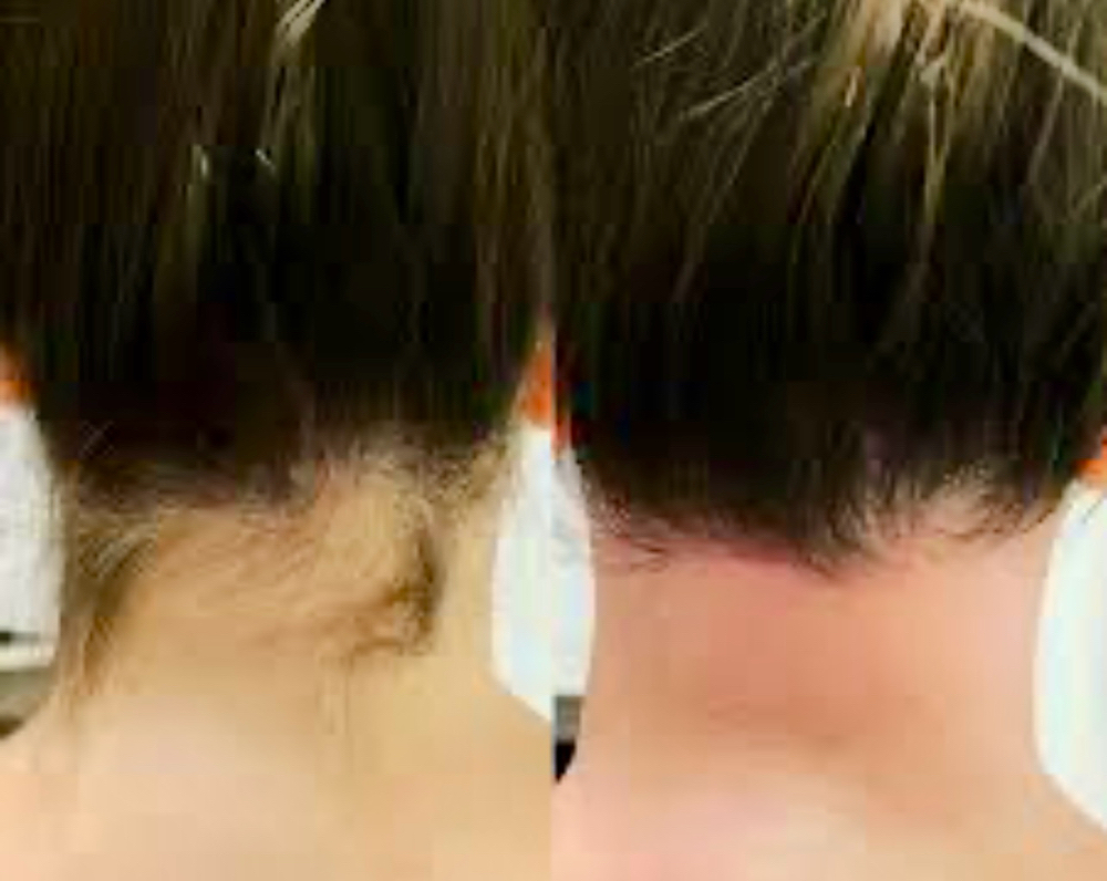 Neck Wax