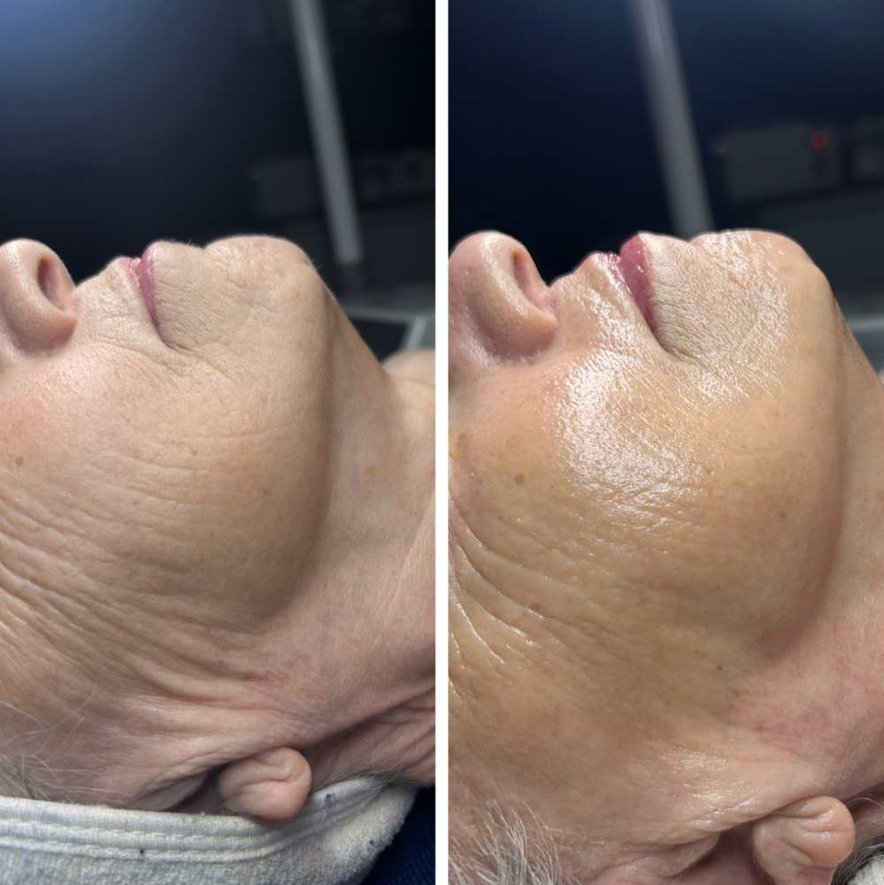 Lunar Luxe Lift Facial