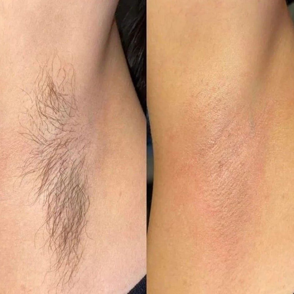Underarm Wax at Bella Vida Beauty Salon in Nacogdoches, TX