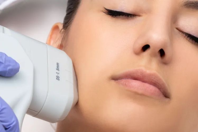 HIFU - Rostro Solo- One Session