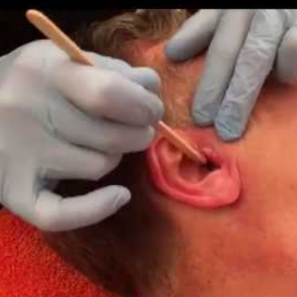 Ear Waxing