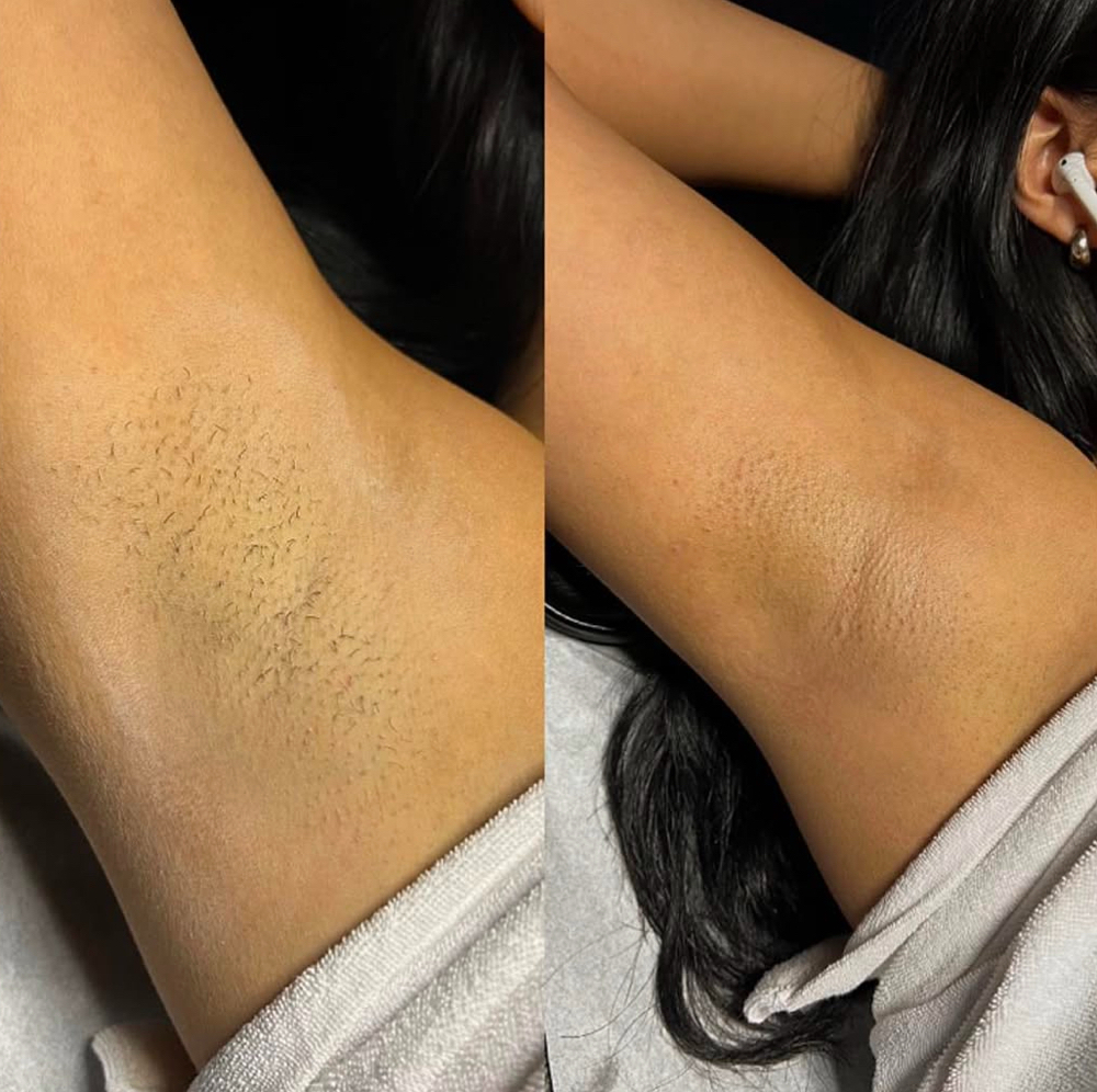 Underarm Wax