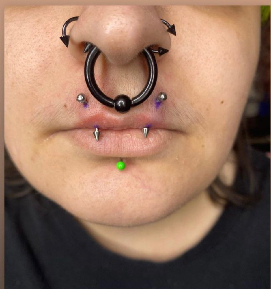 Angel Bites