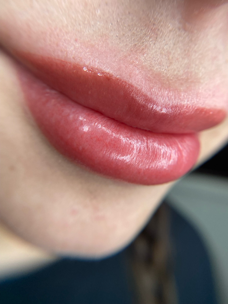 4-6 Week Lip Touchup